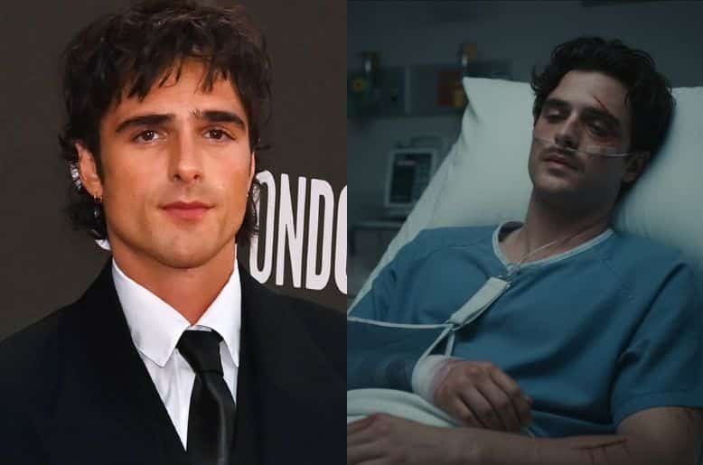 Jacob Elordi , Jacob Elordi hospitalised , Jacob Elordi injuries , Wuthering Heights, Jacob Elordi injured , Jacob Elordi Hospital, Jacob Elordi fans ,