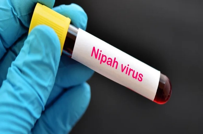 Nipah virus