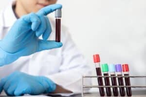 Pakistan to make thalassemia test mandatory before marriage