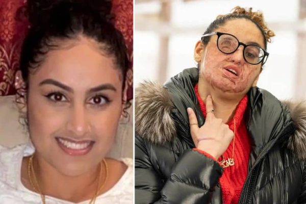 Arrest made in 2021 acid attack on Pakistani student in New York