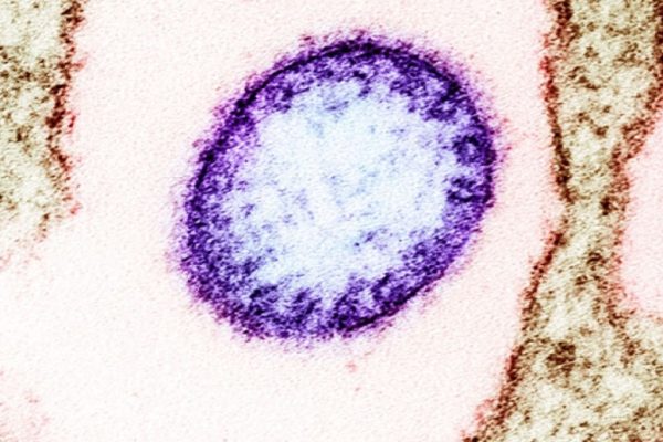 Nipah virus outbreak in India: Five cases confirmed