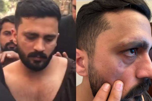 FIR registered in Rajab Butt’s assault case