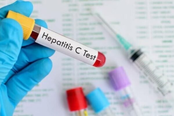 Federal employees to undergo hepatitis C screening from August 18
