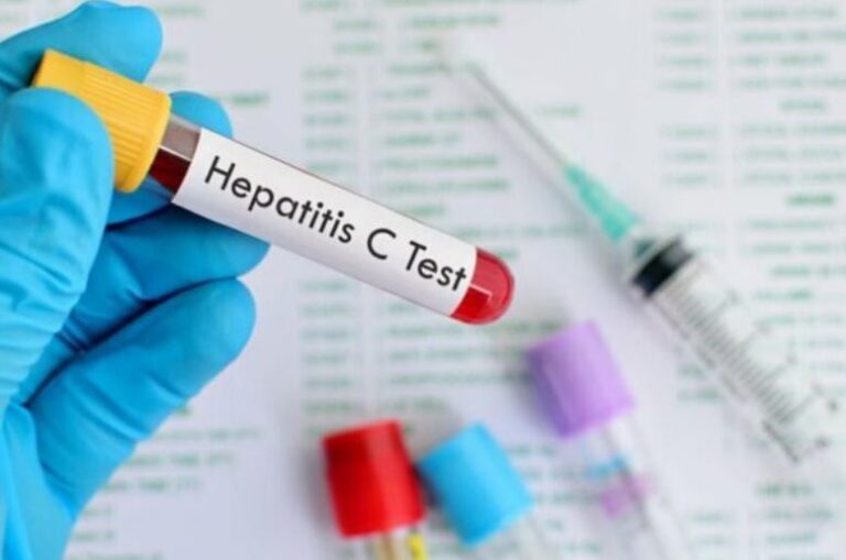Federal employees to undergo hepatitis C screening from August 18