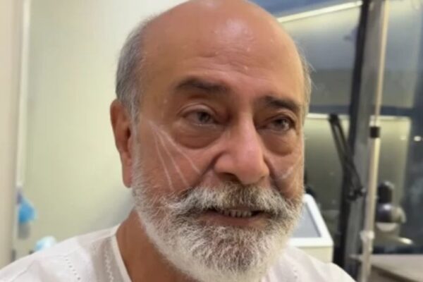 Mohammed Ahmed opens up about facelift, calls it a minor enhancement