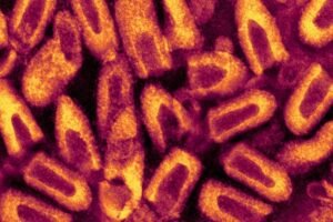 Sindh reports another rabies case